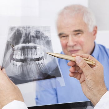 root-canal.jpg